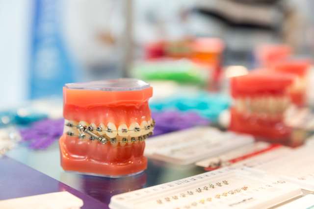 Orthodontic Treatment Process: Brackets, Orthodontic Appliances and More 1 Hospitaprime Orthodontic
