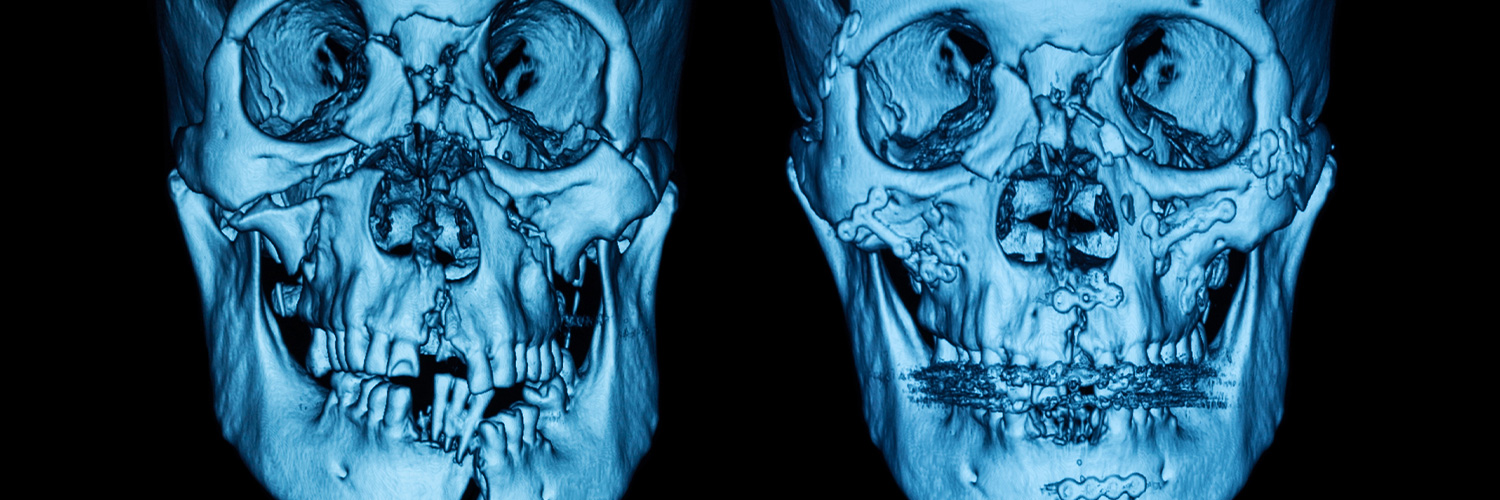 Hospite Maxillofacial Surgery