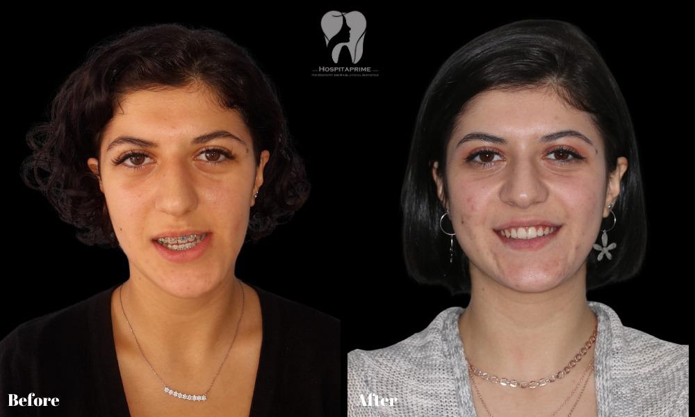 WhatsApp Image 2023-06-20 at 11.53.35 (3)