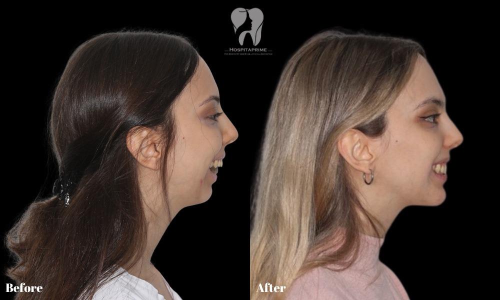 WhatsApp Image 2023-06-20 at 11.53.35 (4)