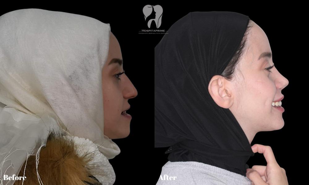 WhatsApp Image 2023-06-20 at 11.53.35 (5)