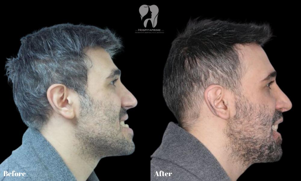 WhatsApp Image 2023-06-20 at 11.53.35