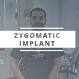Zygomatic implant