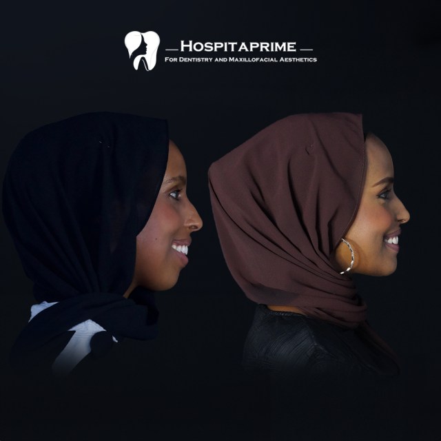 jaw surgery before after 21