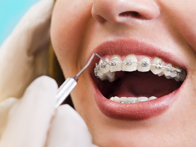 The Benefits of Orthodontic Treatment at Any Age