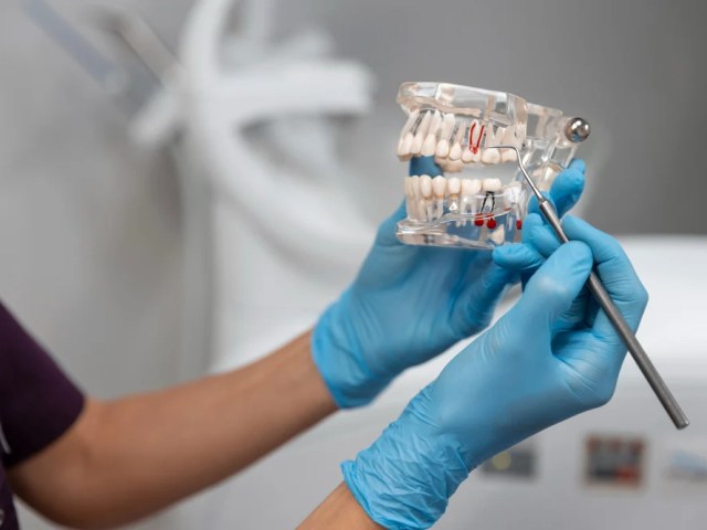 Tips for After Jaw Surgery – 2026 Comprehensive Recovery Guide