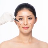 beste gesichts und kieferimplantate