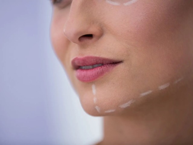 Çene Asimetrisi Nasıl Giderilir? 2026 Güncel Tedavi Yöntemleri