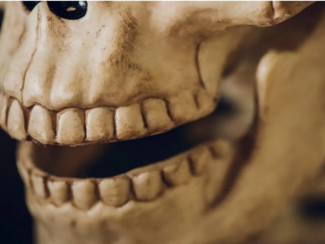 What is Zygoma Bone Fracture? How Is It Treated?